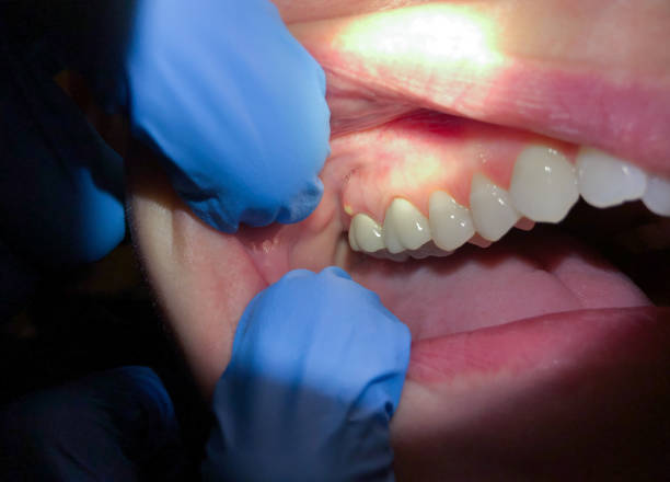Best Mobile Emergency Dentist in Triangle, VA