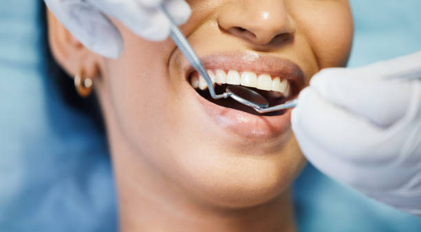 Best Emergency Dental Care for Abscessed Tooth in Triangle, VA