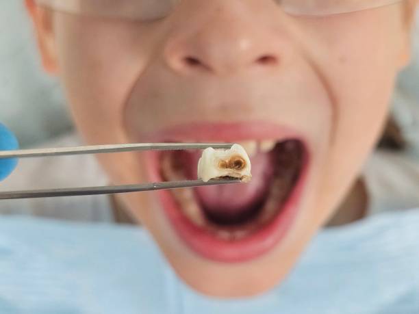 Best Pediatric Emergency Dentist in Triangle, VA